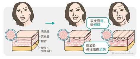 額頭 紋|抬頭紋很深？公開5種抬頭紋主要因素 + 消除方法！